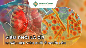 Viêm Phổi Là Gì? 10 Dấu Hiệu Viêm Phổi Ở Người Lớn? Viêm Phổi Là Gì? 10 Dấu Hiệu Viêm Phổi Ở Người Lớn?