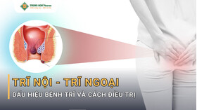 Trĩ Nội, Trĩ Ngoại: 4 Dấu Hiệu Cảnh Báo Bệnh Trĩ Thường Gặp Trĩ Nội, Trĩ Ngoại: 4 Dấu Hiệu Cảnh Báo Bệnh Trĩ Thường Gặp