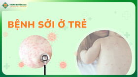 Bệnh sởi ở trẻ em: 4 giai đoạn cần biết và cách chăm sóc nhanh khỏi Bệnh sởi ở trẻ em: 4 giai đoạn cần biết và cách chăm sóc nhanh khỏi