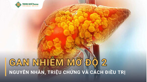 Gan Nhiễm Mỡ Độ 2? Cách Trị Gan Nhiễm Mỡ Cấp Độ 2