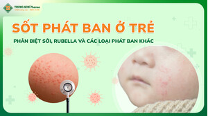 ​Sốt phát ban ở trẻ