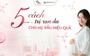 5 Cách Trị Rạn Da Cho Bà Bầu Hiệu Quả