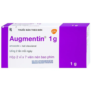 Thuốc kháng sinh Augmentin 1g điều trị ngắn hạn nhiễm khuẩn (2 vỉ x 7 viên)