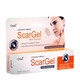 Orlavi ScarGel hỗ trợ làm mờ sẹo (35g)